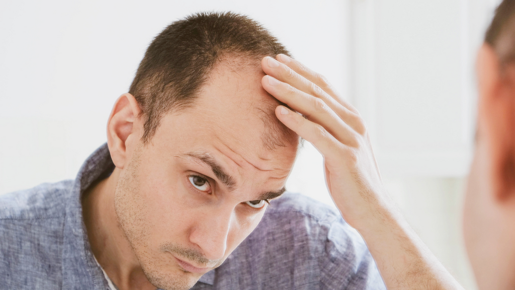 How To Fix Mens Thinning Hair: The Complete Guide