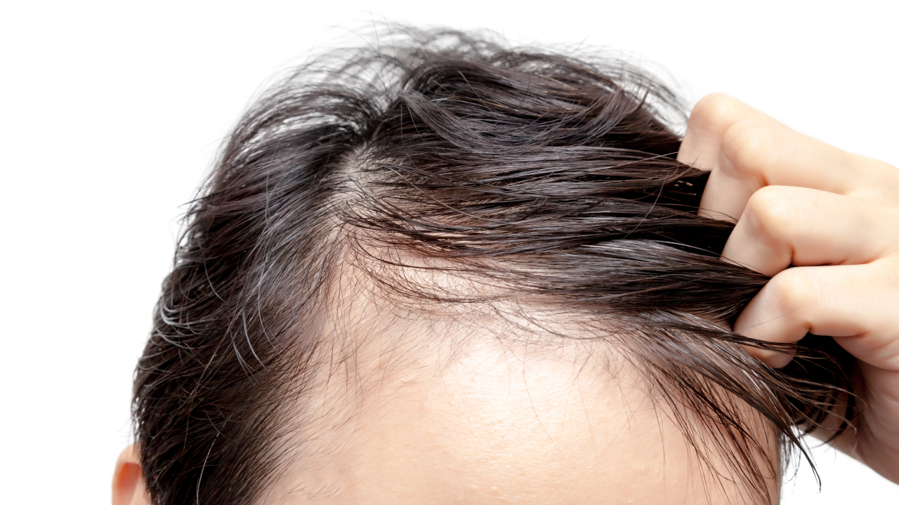 How To Thicken Hair For Men Top 15 Tips