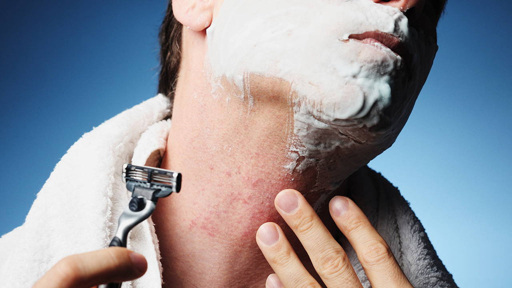 How to Get Rid of Razor Burn Fast: 10 Effective Solutions